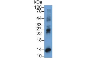 Detection of IP10 in Human Placenta lysate using Monoclonal Antibody to Interferon Gamma Induced Protein 10 kDa (IP10) (CXCL10 anticorps  (AA 22-98))