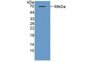 Detection of Recombinant TBP2, Mouse using Polyclonal Antibody to Thioredoxin-interacting Protein (TXNIP) (TXNIP anticorps  (AA 30-381))