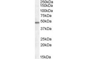 Western Blotting (WB) image for anti-Family with Sequence Similarity 188, Member B (FAM188B) (N-Term) antibody (ABIN2156837) (FAM188B anticorps  (N-Term))