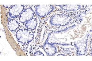 Detection of ACTC1 in Human Colon Tissue using Monoclonal Antibody to Actin Alpha 1, Cardiac Muscle (ACTC1)