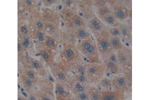 IHC-P analysis of Human Tissue, with DAB staining. (PIK3CB anticorps  (AA 524-703))