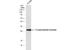 WB Image Triosephosphate isomerase antibody detects Triosephosphate isomerase protein by western blot analysis. (TPI1 anticorps  (C-Term))