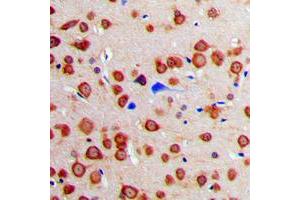 Immunohistochemical analysis of Calmodulin staining in human brain formalin fixed paraffin embedded tissue section.