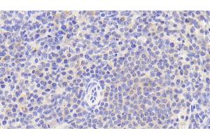 Detection of CD5 in Human Spleen Tissue using Polyclonal Antibody to Cluster Of Differentiation 5 (CD5)