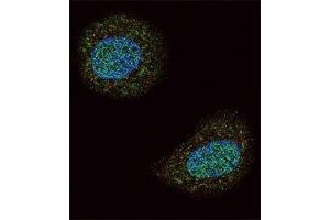 Confocal immunofluorescent analysis of PTEN antibody with MCF-7 cells followed by Alexa Fluor 488-conjugated goat anti-rabbit lgG (green).
