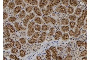 ABIN6276922 at 1/100 staining Rat kidney tissue by IHC-P. (IKZF1 anticorps  (Internal Region))