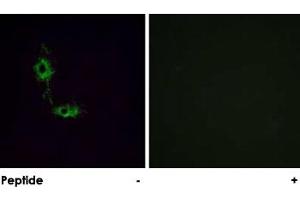 Immunofluorescence analysis of HeLa cells, using GRIA1 polyclonal antibody .