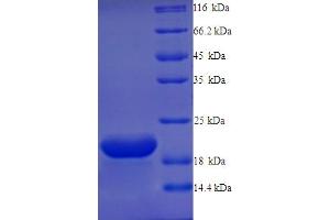 SDS-PAGE (SDS) image for G Protein-Coupled Receptor 75 (GPR75) (AA 372-540) protein (His tag) (ABIN5713482)