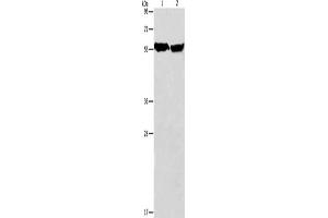 Gel: 8 % SDS-PAGE, Lysate: 40 μg, Lane 1-2: Mouse heart tissue, human fetal brain tissue, Primary antibody: ABIN7128507(ARHGEF9 Antibody) at dilution 1/950, Secondary antibody: Goat anti rabbit IgG at 1/8000 dilution, Exposure time: 5 seconds (Arhgef9 anticorps)