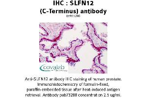 anti-Schlafen Family Member 12 (SLFN12) (C-Term) antibody