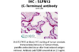Image no. 1 for anti-Schlafen Family Member 12 (SLFN12) (C-Term) antibody (ABIN1739425) (SLFN12 anticorps  (C-Term))