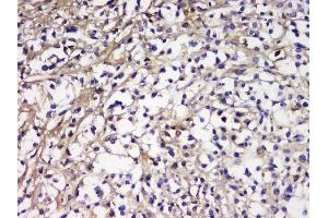 IHC analysis of IGLL1 using anti-IGLL1 antibody (ABIN6719329). (IGLL1 anticorps)