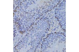 Immunohistochemistry of paraffin-embedded mouse testis using JMJD6 Antibody (ABIN5973452) at dilution of 1/100 (40x lens). (JMJD6 anticorps)