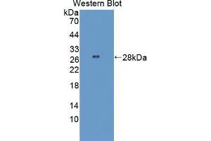 Western blot analysis of the recombinant protein. (STING/TMEM173 anticorps  (AA 160-371))