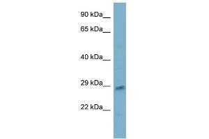 WB Suggested Anti-ING5 Antibody Titration:  0. (ING5 anticorps  (N-Term))