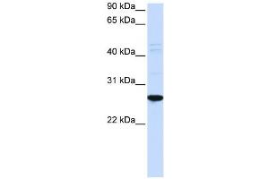 Western Blotting (WB) image for anti-Dorsal Root Ganglia Homeobox (DRGX) antibody (ABIN2459124) (DRGX anticorps)