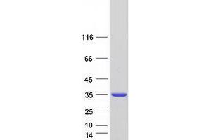 Validation with Western Blot