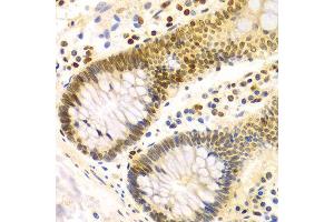 Immunohistochemistry of paraffin-embedded Human colon using DKC1 antibody at dilution of 1:100 (x400 lens). (DKC1 anticorps)