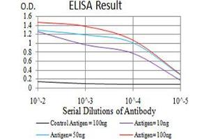 Black line: Control Antigen (100 ng);Purple line: Antigen (10ng); Blue line: Antigen (50 ng); Red line:Antigen (100 ng) (CPV-VP2 (AA 1-128) anticorps)