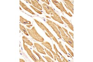 Antibody staining VLDLR in human heart tissue sections by Immunohistochemistry (IHC-P - paraformaldehyde-fixed, paraffin-embedded sections).