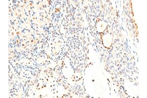 ABIN6267283 at 1/100 staining rat ovarian tissue sections by IHC-P.