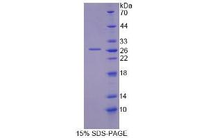 SDS-PAGE analysis of Mouse GFM2 Protein. (GFM2 Protéine)