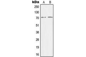Western blot analysis of CRSP7 expression in HEK293T (A), HeLa (B) whole cell lysates.