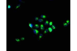 Immunofluorescence staining of Hela cells with ABIN7146723 at 1:66, counter-stained with DAPI.