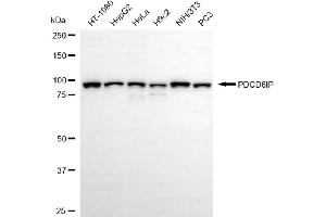 Western blotting analysis using PDCD6IP antibody (ABIN7799908).