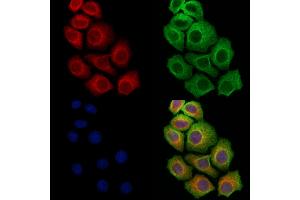 ABIN7094423 and ABIN7098470 staining Hela cells by IF/ICC.
