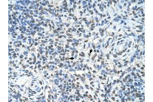 ZMYND11 antibody was used for immunohistochemistry at a concentration of 4-8 ug/ml to stain Spleen cells (arrows) in Human Spleen.