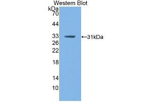 Detection of Recombinant F13A1, Mouse using Polyclonal Antibody to Coagulation Factor XIII A1 Polypeptide (F13A1)