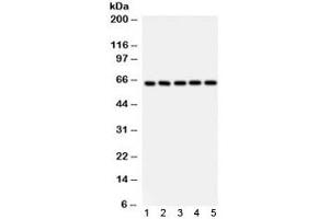 Western blot testing of 1) rat thymus, 2) mouse testis, human 3) Jurkat, 4) K562 and 5) HeLa lysate using SHC antibody. (SHC1 anticorps)