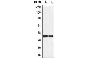 Western blot analysis of ANT2 expression in A549 (A), PC12 (B) whole cell lysates.