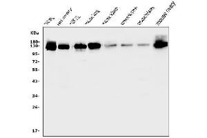 Western blot analysis of MCAM using anti-MCAM antibody (ABIN7601026). (MCAM anticorps  (AA 27-621))