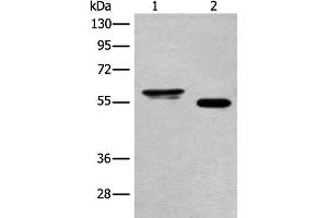 Western blot analysis of Human cervical cancer tissue and A549 cell lysates using HAS3 Polyclonal Antibody at dilution of 1:400