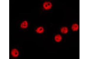 ABIN6267446 staining MCF7 by IF/ICC.