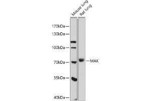 Western blot analysis of extracts of various cell lines, using MAK antibody (ABIN7268382) at 1:1000 dilution. (MAK anticorps  (AA 370-435))