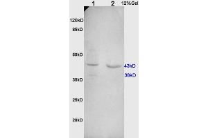 L1 rat kidney, L2 human colon carcinoma lysates probed (ABIN732098) at 1:200 in 4 °C. (Cathepsin D anticorps  (AA 101-200))