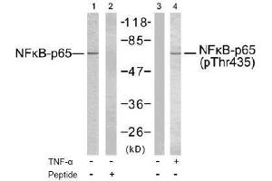 Image no. 2 for anti-Nuclear Factor-kB p65 (NFkBP65) (Thr435) antibody (ABIN197112) (NF-kB p65 anticorps  (Thr435))