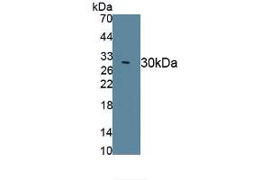 Detection of Recombinant DRD2, Canine using Polyclonal Antibody to Dopamine Receptor D2 (DRD2)