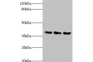 Western blot All lanes: TMOD3 antibody at 5 μg/mL Lane 1: Jurkat whole cell lysate Lane 2: MCF-7 whole cell lysate Lane 3: Hela whole cell lysate Secondary Goat polyclonal to rabbit IgG at 1/10000 dilution Predicted band size: 40 kDa Observed band size: 40 kDa (TMOD3 anticorps  (AA 1-352))