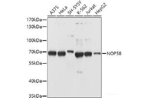 Western blot analysis of extracts of various cell lines using NOP58 Polyclonal Antibody at dilution of 1:1000. (NOP58 anticorps)