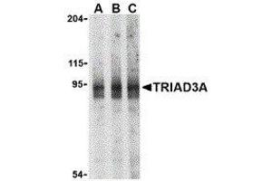 Western Blotting (WB) image for anti-Ring Finger Protein 216 (RNF216) (N-Term) antibody (ABIN2476944) (RNF216 anticorps  (N-Term))