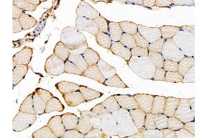ABIN6262613 and ABIN6266565 at 1/100 staining Mouse muscle tissue by IHC-P. (Integrin beta 5 anticorps  (C-Term))