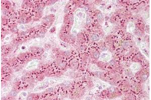 Anti-TGOLN2 / TGN46 antibody IHC staining of human liver.