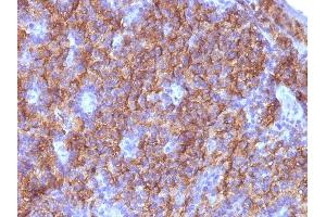 Formalin-fixed, paraffin-embedded Parathyroid stained with Chromogranin A Monoclonal Antibody (CGA/413+ CHGA/777+ CHGA/798)