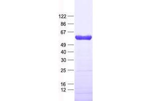 Validation with Western Blot