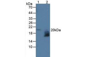 Figure. (WFDC2 anticorps  (AA 30-124))