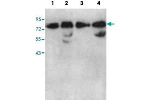 Western blot analysis of HeLa cell (Lane 1), human fetal kidney (Lane 2), K-562 cell (Lane 3) and fetal lung (Lane 4) lysate with AARSD1 polyclonal antibody  at 1 : 1000 dilution. (AARSD1 anticorps  (AA 278-522))